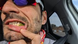 A nosotros al menos nos funcionó el estar todo el día masticando hojas de coca