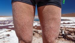 Tremendo cómo se queda el cuerpo tras bañarse en las lagunas saladas de Baltinache